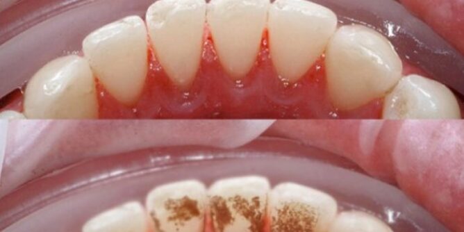 649aac6b-9f5c-4a18-8f4e-46d30a0a0a64-zubi2-690x480-1-668x334-1