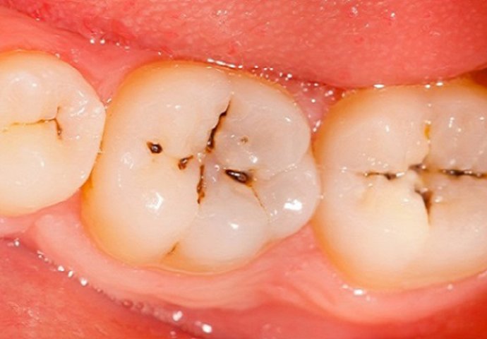 5bddb193-4024-4c55-a405-2c840a0a0a67-karijes-690x480-1