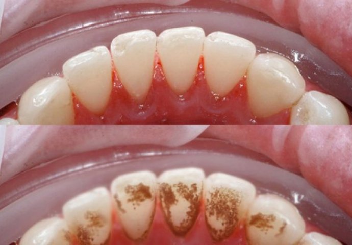 649aac6b-9f5c-4a18-8f4e-46d30a0a0a64-zubi2-690x480-1