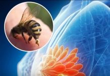 Pčelinji otrov ubio stanice raka dojke u manje od sat vremena